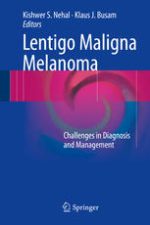 lentigo maligna melanoma challenges in diagnosis and management