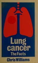 lung cancer the facts
