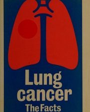 lung cancer the facts