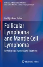 lymphoma pathology diagnosis and treatment 2 edition
