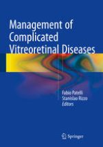 management of complicated vitreoretinal diseases august 2015 release