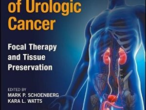 management of urologic cancer focal therapy and tissue preservation