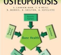 managing osteoporosis