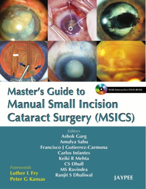 manual small incision cataract surgery