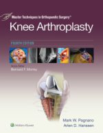 master techniques in orthopaedic surgery knee arthroplasty 3rd edition