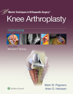 master techniques in orthopaedic surgery knee arthroplasty 3rd edition