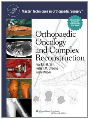 master techniques in orthopaedic surgery orthopaedic oncology and complex reconstruction