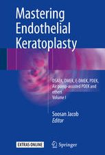 mastering endothelial keratoplasty volume i