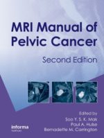mri manual of pelvic cancer second edition