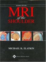 mri of the shoulder 2nd edition