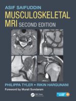 musculoskeletal mri second edition