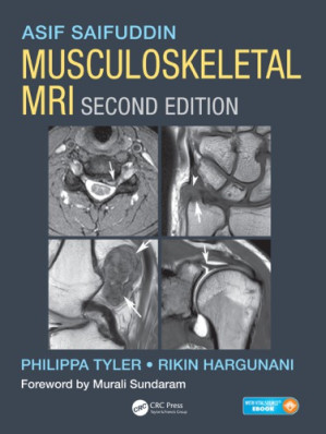 musculoskeletal mri second edition