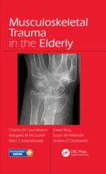 musculoskeletal trauma in the elderly