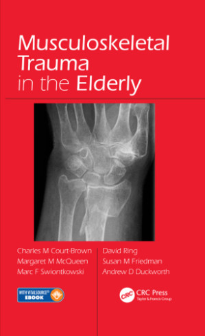 musculoskeletal trauma in the elderly