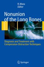 nonunion of the long bones diagnosis and treatment with compression distraction techniques
