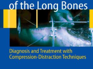 nonunion of the long bones diagnosis and treatment with compression distraction techniques