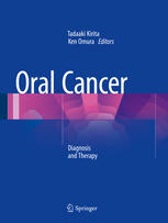 oral cancer diagnosis and therapy