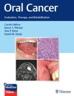 oral cancer evaluation therapy and rehabilitation 1st edition
