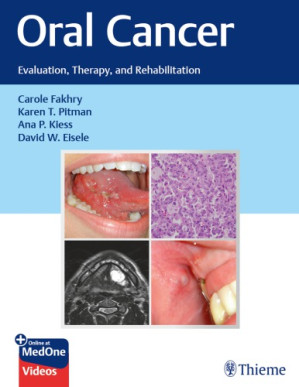 oral cancer evaluation therapy and rehabilitation 1st edition