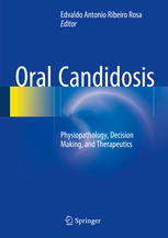 oral candidosis physiopathology decision making and therapeutics