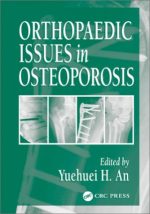 orthopaedic issues in osteoporosis