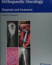 orthopaedic oncology diagnosis and treatment