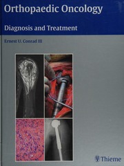 orthopaedic oncology diagnosis and treatment
