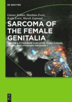 other rare sarcomas mixed tumors genital sarcomas and pregnancy