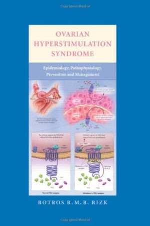 ovarian hyperstimulation syndrome epidemiology pathophysiology prevention and management