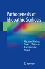 pathogenesis of idiopathic scoliosis