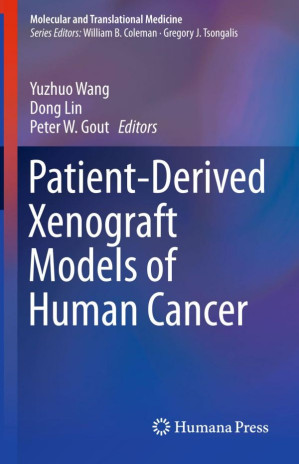 patient derived xenograft models of human cancer