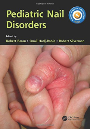 pediatric nail disorders