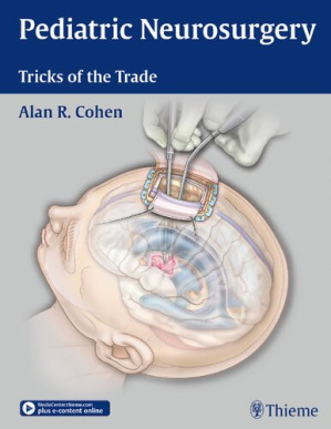 pediatric neurosurgery tricks of the trade