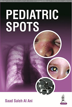 pediatric spots