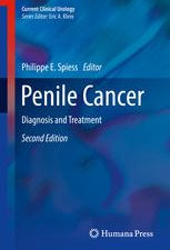 penile cancer diagnosis and treatment