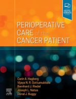 perioperative care of the cancer patient 1st edition