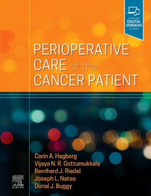 perioperative care of the cancer patient 1st edition