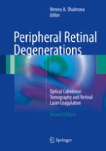 peripheral retinal degenerations optical coherence tomography and retinal laser coagulation 2nd edition