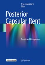 posterior capsular rent genesis and management