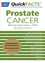 prostate cancer 2 edition the facts