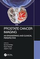 prostate cancer imaging an engineering and clinical perspective 1st edition