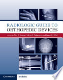 radiologic guide to orthopedic devices