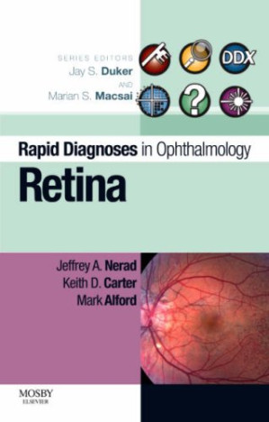 rapid diagnosis in ophthalmology series retina 1st edition