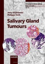 salivary gland tumours