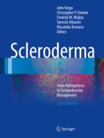 scleroderma from pathogenesis to comprehensive management second edition