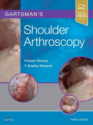 shoulder arthroscopy 3rd edition
