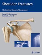 shoulder fractures the practical guide to management