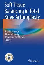soft tissue balancing in total knee arthroplasty