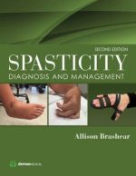 spasticity diagnosis and management 2nd edition