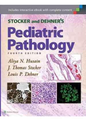stocker and dehner s pediatric pathology 4th edition december 2015 release